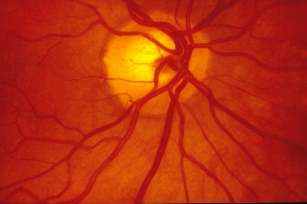 Human Retina